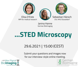 Ask the experts: STED microscopy 